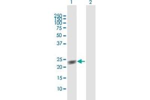 Western Blot analysis of GUK1 expression in transfected 293T cell line by GUK1 MaxPab polyclonal antibody. (GUK1 antibody  (AA 1-197))
