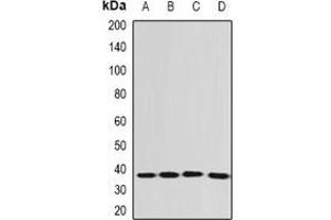 Western blot analysis of EEF1D expression in SHSY5Y (A), Jurkat (B), A549 (C), mouse spleen (D) whole cell lysates.