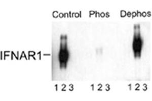 Western blot of immunoprecipitates from HEK 293 cells transfected with 1. (IFNAR1 antibody  (pSer535, pSer539))