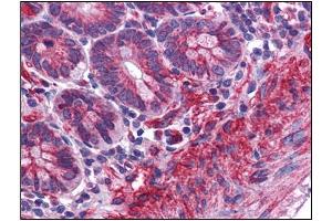 Human Small Intestine: Formalin-Fixed, Paraffin-Embedded (FFPE) (MTCH2 antibody  (N-Term))