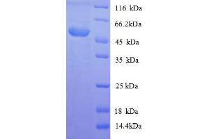 SDS-PAGE (SDS) image for Lysophospholipase I (LYPLA1) (AA 1-230), (full length) protein (GST tag) (ABIN5709887)