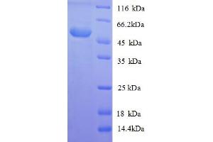 SDS-PAGE (SDS) image for Lysophospholipase I (LYPLA1) (AA 1-230), (full length) protein (GST tag) (ABIN5709887) (LYPLA1 Protein (AA 1-230, full length) (GST tag))