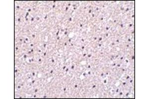 Immunohistochemistry of Presenilin1 in human brain tissue with this product at 2. (Presenilin 1 antibody  (C-Term))