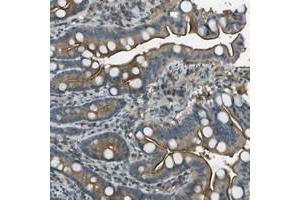 Immunohistochemical staining of human duodenum with LRRC66 polyclonal antibody  shows moderate cytoplasmic and membranous positivity in glandular cells at 1:20-1:50 dilution. (LRRC66 antibody)