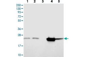 Western blot analysis of Lane 1: RT-4, Lane 2: U-251 MG, Lane 3: Human Plasma, Lane 4: Liver, Lane 5: Tonsil with KCNG1 polyclonal antibody  at 1:250-1:500 dilution. (KCNG1 antibody)