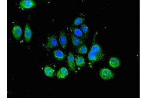 Immunofluorescence (IF) image for anti-SLU7 Splicing Factor Homolog (SLU7) (AA 138-310) antibody (ABIN7164181)