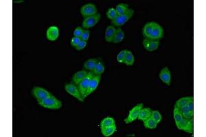 Immunofluorescent analysis of HepG2 cells using ABIN7150711 at dilution of 1:100 and Alexa Fluor 488-congugated AffiniPure Goat Anti-Rabbit IgG(H+L) (MAP2K4 antibody  (AA 259-398))