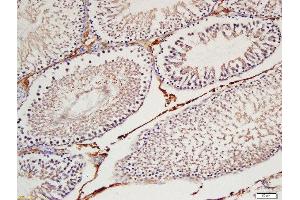 Formalin-fixed and paraffin embedded  labeled with Rabbit Anti-Cyclin H Polyclonal Antibody, Unconjugated (ABIN734408) at 1:200 followed by conjugation to the secondary antibody and DAB staining (Cyclin H antibody  (AA 221-323))
