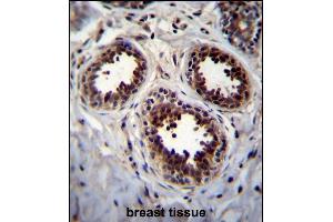 EIF4EBP1 Antibody (Center) (ABIN656558 and ABIN2845820) immunohistochemistry analysis in formalin fixed and paraffin embedded human breast tissue followed by peroxidase conjugation of the secondary antibody and DAB staining. (eIF4EBP1 antibody  (AA 31-61))