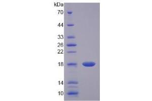 SDS-PAGE (SDS) image for Interleukin 17 (IL17) (AA 18-150) protein (His tag) (ABIN4988291)