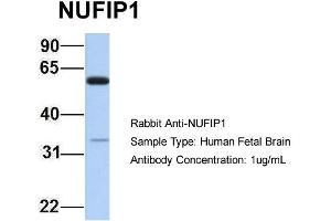 Host: Rabbit Target Name: NUFIP1 Sample Type: Human Fetal Brain Antibody Dilution: 1.