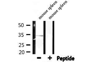 Western blot analysis of extracts from mouse spleen, using RPL5 Antibody.