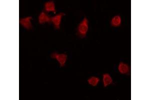 ABIN6275297 staining HT29 by IF/ICC. (NXPH3 antibody  (Internal Region))