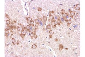 Formalin-fixed and paraffin embedded: rat brain tissue labeled with Anti-beta-Amyloid(1-42) Polyclonal Antibody , Unconjugated 1:200 followed by conjugation to the secondary antibody and DAB staining (Abeta 1-42 antibody  (AA 1-42))