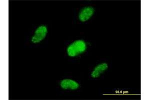 Immunofluorescence of purified MaxPab antibody to ZNF446 on HepG2 cell. (ZNF446 antibody  (AA 1-450))
