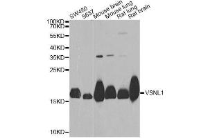 Western blot analysis of extracts of various cell lines, using VSNL1 Antibody. (VSNL1 antibody  (AA 1-191))