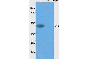 Lane 1: mouse brain lysates Lane 2: human colon carcinoma lysates probed with Anti SynCAM/TSLC1 Polyclonal Antibody, Unconjugated (ABIN761351) at 1:200 in 4 °C.