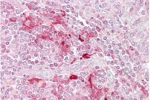 Immunohistochemistry with Spleen tissue at an antibody concentration of 5µg/ml using anti-ETV5 antibody (ARP32264_P050) (ETV5 antibody  (N-Term))