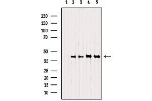 Western blot analysis of extracts from various samples, using NSDHL Antibody. (NSDHL antibody  (Internal Region))