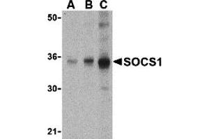 Western Blotting (WB) image for anti-Suppressor of Cytokine Signaling 1 (SOCS1) (N-Term) antibody (ABIN1031580) (SOCS1 antibody  (N-Term))