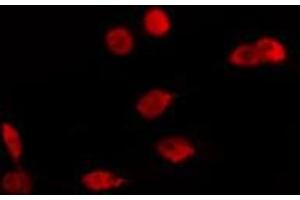 ABIN6274113 staining Hela cells by IF/ICC. (LMX1B antibody  (Internal Region))