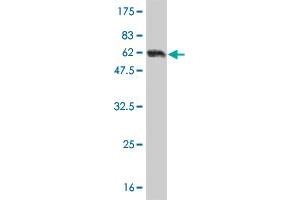 Western Blot detection against Immunogen (62. (AMBP antibody  (AA 19-352))