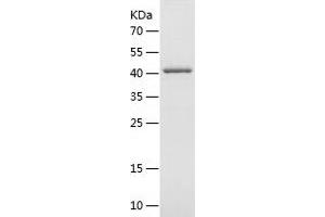 Western Blotting (WB) image for V-Akt Murine Thymoma Viral Oncogene Homolog 1 (AKT1) (AA 1-149) protein (GST tag) (ABIN7281758) (AKT1 Protein (AA 1-149) (GST tag))