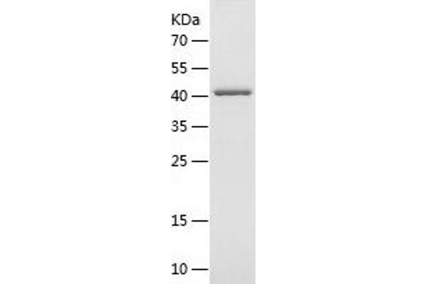 AKT1 Protein (AA 1-149) (GST tag)