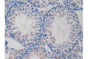 IHC-P analysis of Mouse Testis Tissue, with DAB staining. (OLR1 antibody  (AA 60-312))