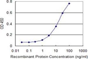 Detection limit for recombinant GST tagged ALDH18A1 is 0. (P5CS antibody  (AA 696-795))