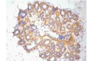 Immunohistochemistry (IHC) staining of Human Ovary tissue, diluted at 1:200. (beta Actin antibody)