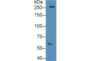 Detection of FN in Rat Serum using Polyclonal Antibody to Fibronectin (FN) (Fibronectin antibody  (AA 355-558))