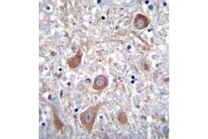 Formalin fixed and paraffin embedded human brain tissue reacted with PTCHD1 Antibody (Center) followed by peroxidase conjugation of the secondary antibody and DAB staining. (PTCHD1 antibody  (Middle Region))