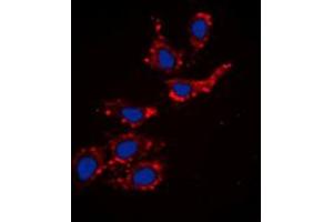 Immunofluorescence (IF) image for anti-Collagen, Type XVIII, alpha 1 (COL18A1) (Center) antibody (ABIN2982660) (COL18A1 antibody  (Center))