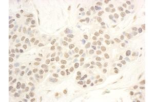 Immunohistochemistry (IHC) image for anti-NOP56 Ribonucleoprotein Homolog (NOP56) (AA 494-544) antibody (ABIN7453746)