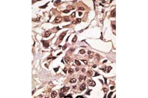 Image no. 2 for anti-Bone Morphogenetic Protein Receptor 1A (BMPR1A) (N-Term) antibody (ABIN357374) (BMPR1A antibody  (N-Term))