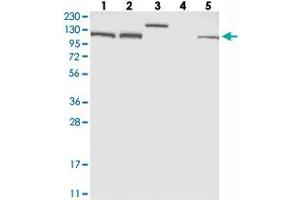 Western blot analysis of Lane 1: RT-4, Lane 2: U-251 MG, Lane 3: Human Plasma, Lane 4: Liver, Lane 5: Tonsil with EFTUD2 polyclonal antibody  at 1:250-1:500 dilution.