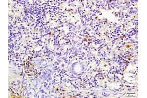 Formalin-fixed and paraffin embedded rabbit pancreas labeled with Rabbit Anti pro-caspase-3 Polyclonal Antibody, Unconjugated (ABIN747728) at 1:200 followed by conjugation to the secondary antibody and DAB staining