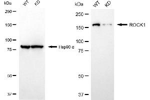 Western blotting analysis using ROCK1 antibody (ABIN7800203). (Recombinant ROCK1 antibody)