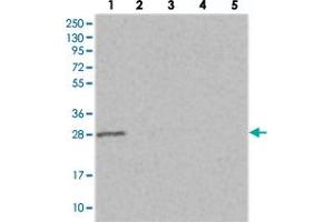 Western blot analysis of Lane 1: RT-4, Lane 2: U-251 MG, Lane 3: Human Plasma, Lane 4: Liver, Lane 5: Tonsil with ERP29 polyclonal antibody . (ERP29 antibody)