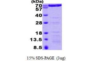 SDS-PAGE (SDS) image for Annexin A6 (ANXA6) (AA 1-673) protein (His tag) (ABIN667759)