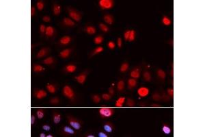 Immunofluorescence analysis of U2OS cells using MPG Polyclonal Antibody