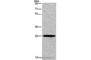 Western blot analysis of Human bladder carcinoma tissue, using KLRF1 Polyclonal Antibody at dilution of 1:300