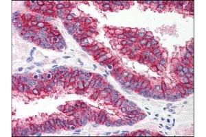 Image no. 1 for anti-Toll-Like Receptor 5 (TLR5) (Center) antibody (ABIN303300) (TLR5 antibody  (Center))