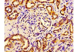Immunohistochemistry of paraffin-embedded human kidney tissue using ABIN7152106 at dilution of 1:100 (EIF4A2 antibody  (AA 1-407))