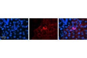 SHMT2 antibody - C-terminal region          Formalin Fixed Paraffin Embedded Tissue:  Human Liver Tissue    Observed Staining:  Cytoplasm in Kupffer cells   Primary Antibody Concentration:  1:600    Secondary Antibody:  Donkey anti-Rabbit-Cy3    Secondary Antibody Concentration:  1:200    Magnification:  20X    Exposure Time:  0. (SHMT2 antibody  (C-Term))