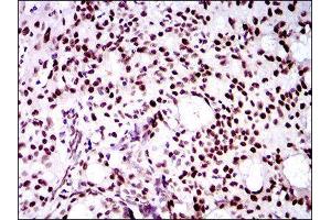 Immunohistochemistry (IHC) image for anti-Twist Homolog 1 (Drosophila) (TWIST1) (AA 9-74) antibody (ABIN1842915) (TWIST1 antibody  (AA 9-74))