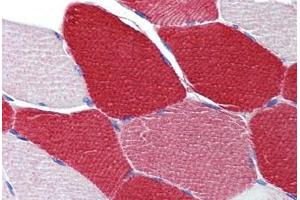 Skeletal muscle, Human: Formalin-Fixed, Paraffin-Embedded (FFPE) (MYL6 antibody  (AA 72-121))