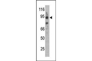 The anti-Synphilin-1 C-term Pab is used in Western blot to detect Synphilin-1 in mouse brain lysate. (SNCAIP antibody  (C-Term))
