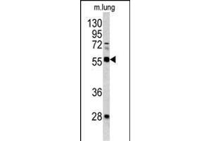 Western blot analysis of FLI1 antibody (Center) (ABIN390409 and ABIN2840798) in mouse lung tissue lysates(35 μg/lane). (FLI1 antibody  (AA 299-328))